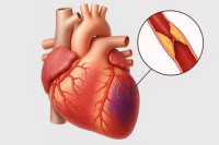 Почему нельзя игнорировать болезни сердца